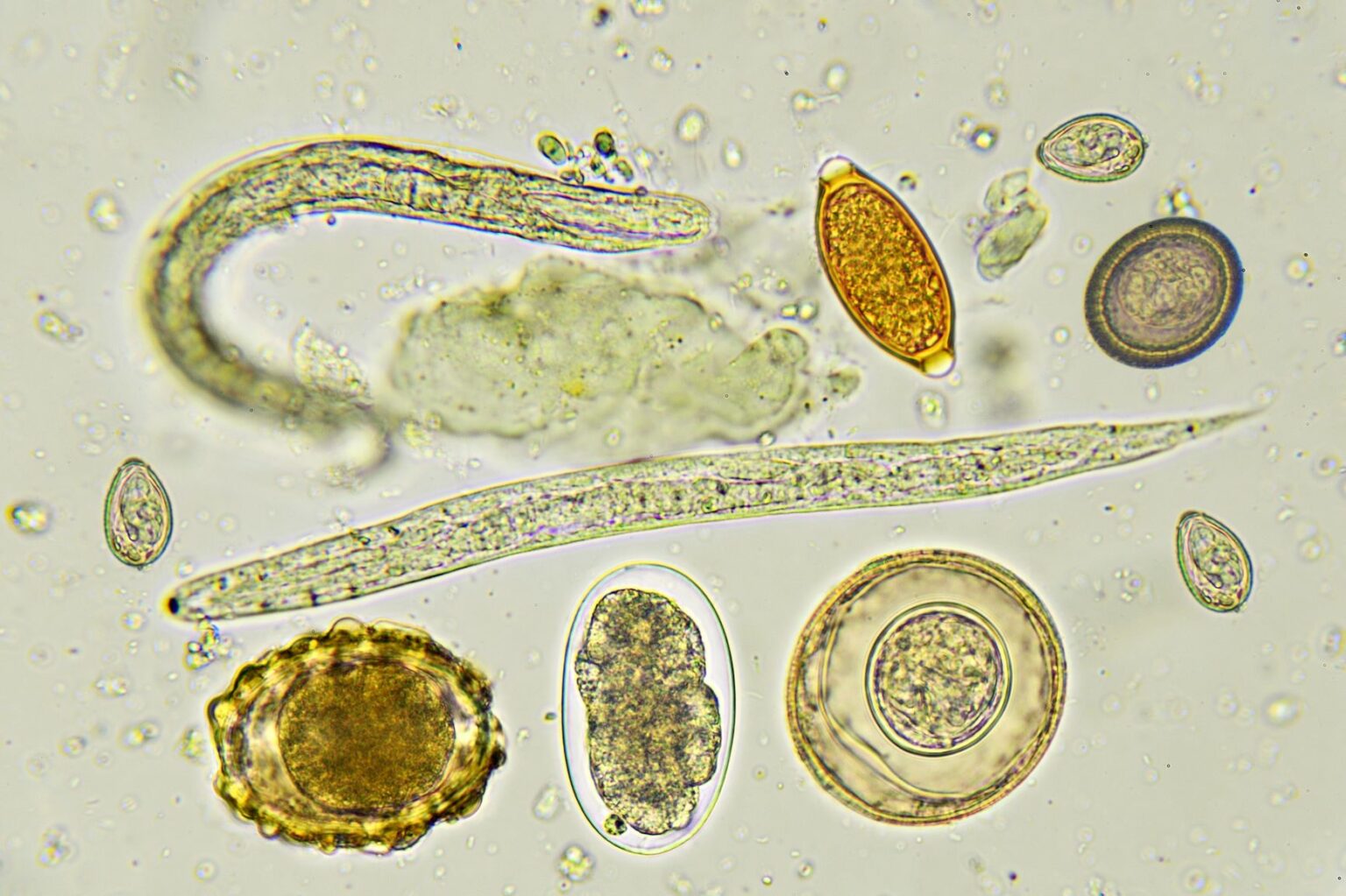 wormen wormeneitjes microscoop